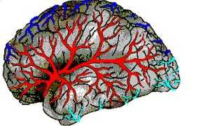Болезнь сосудов головного мозга как называется