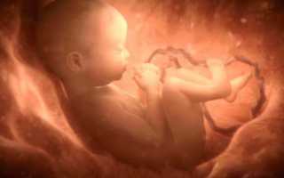 Внутриутробная гипоксия плода и новорожденного