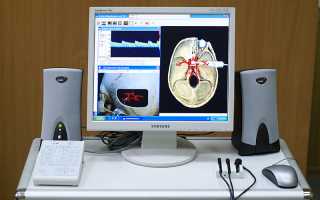 Транстемпоральное сканирование головного мозга