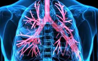 Тромбоз легочной артерии симптомы и лечение