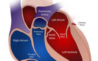 Атеросклероз грудной аорты и коронарных артерий