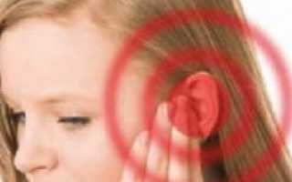 Болит голова закладывает уши давление в норме