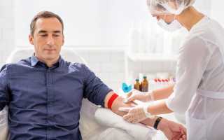 Повышение лимфоцитов в крови у мужчин причины