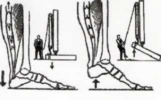 Упражнения при варикозе ног метод микулина
