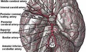 Формирование артериального круга большого мозга