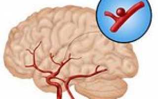 Как лечить аневризму сосудов головного мозга